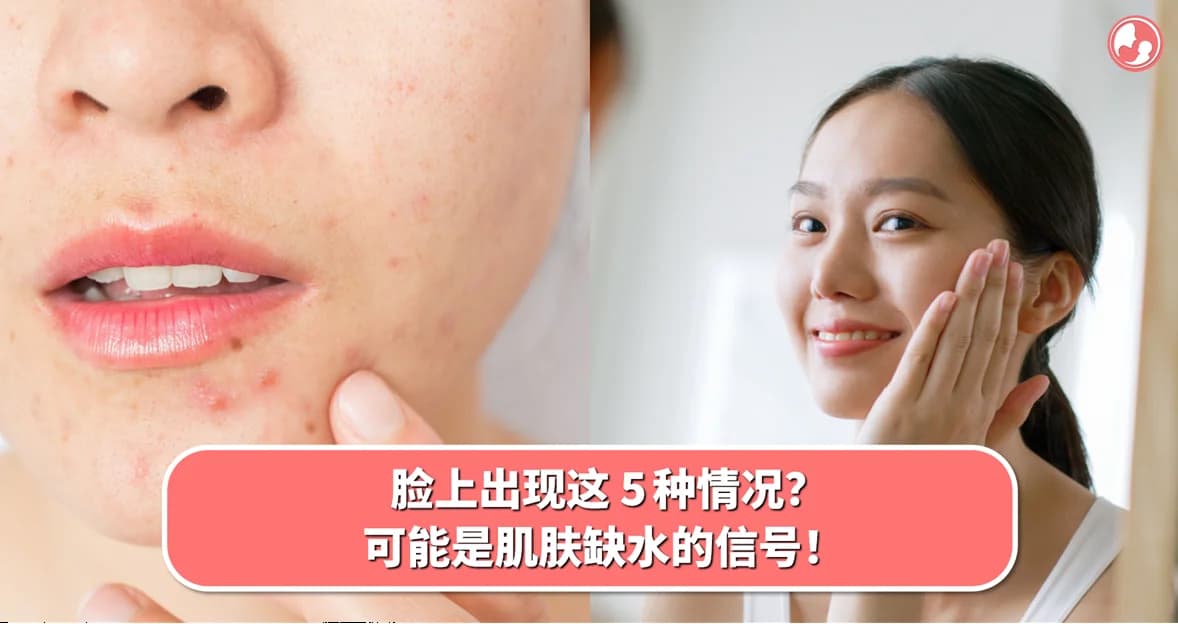脸上出现这 5 种情况?可能是肌肤缺水的信号!