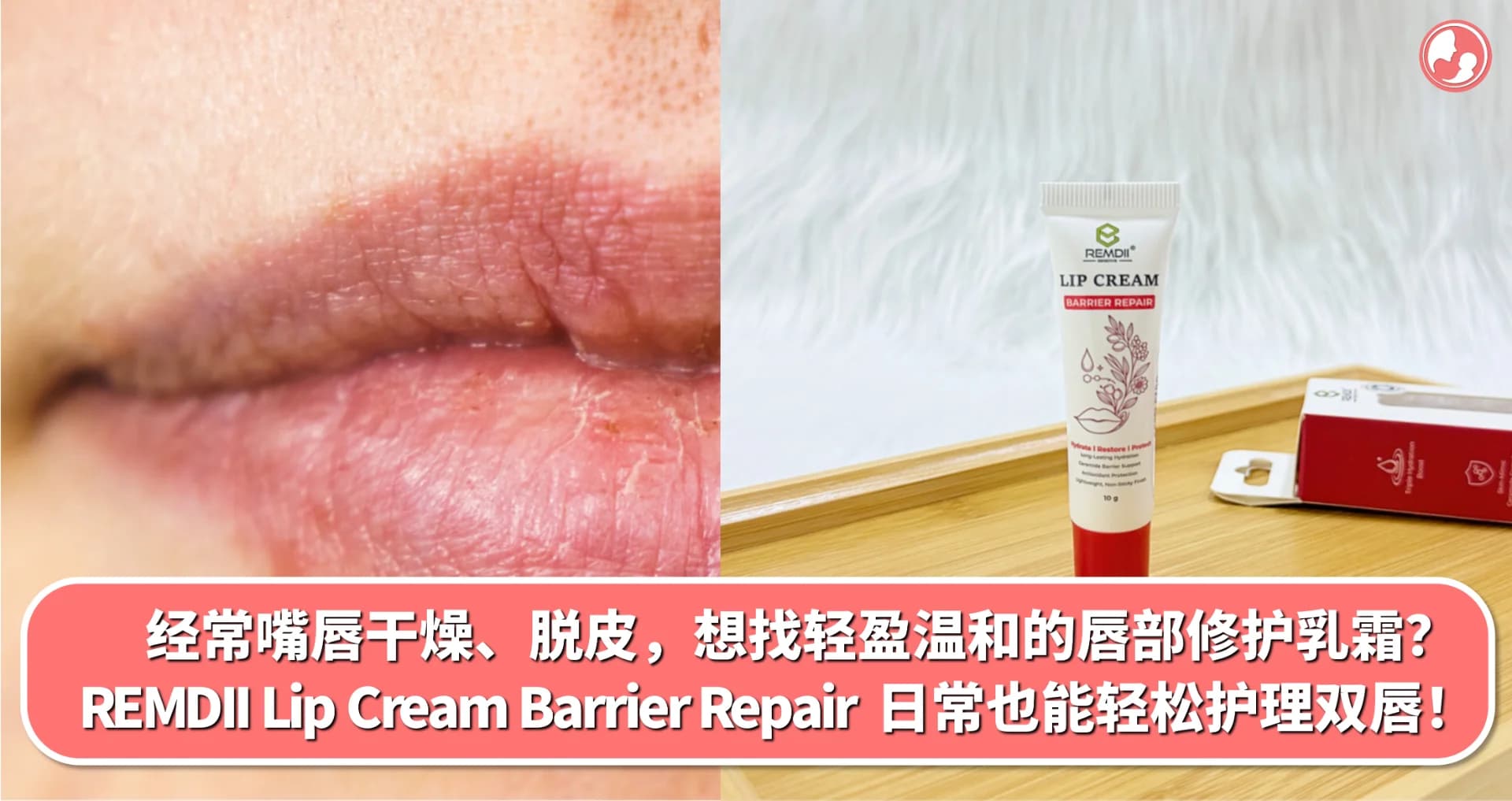 经常嘴唇干燥、脱皮,想找轻盈温和的唇部修护乳霜?𝐑𝐄𝐌𝐃𝐈𝐈 𝐋𝐢𝐩 𝐂𝐫𝐞𝐚𝐦 𝐁𝐚𝐫𝐫𝐢𝐞𝐫 𝐑𝐞𝐩𝐚𝐢𝐫 日常也能轻松护理双唇!