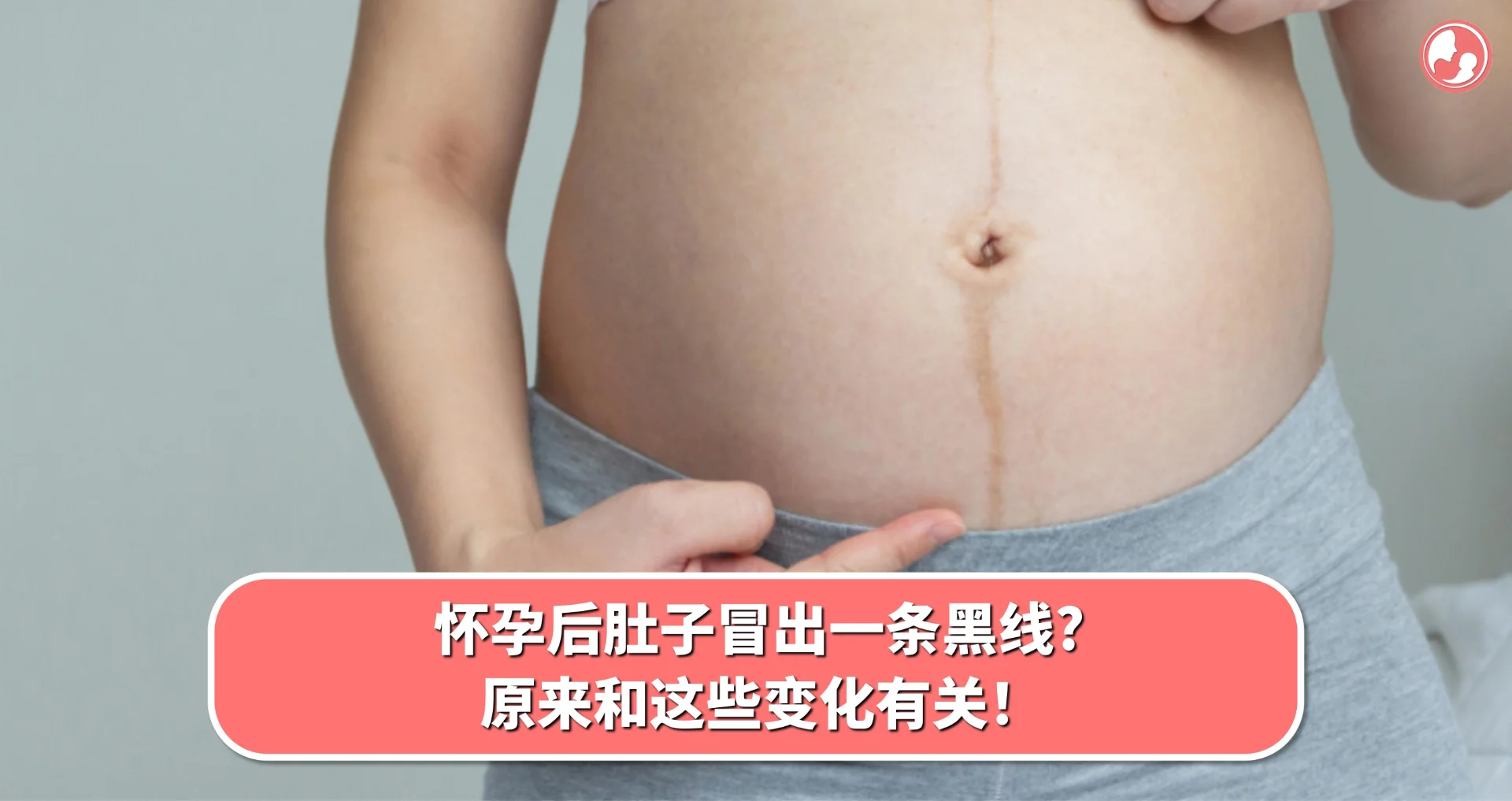 【妊娠纹】 怀孕后肚子冒出一条黑线?原来和这些变化有关!