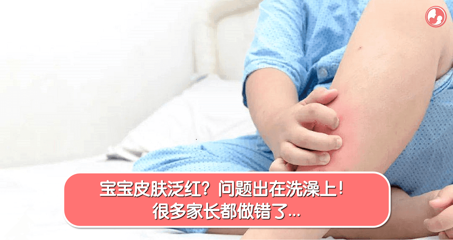宝宝皮肤泛红?问题出在洗澡上!很多家长都做错了…