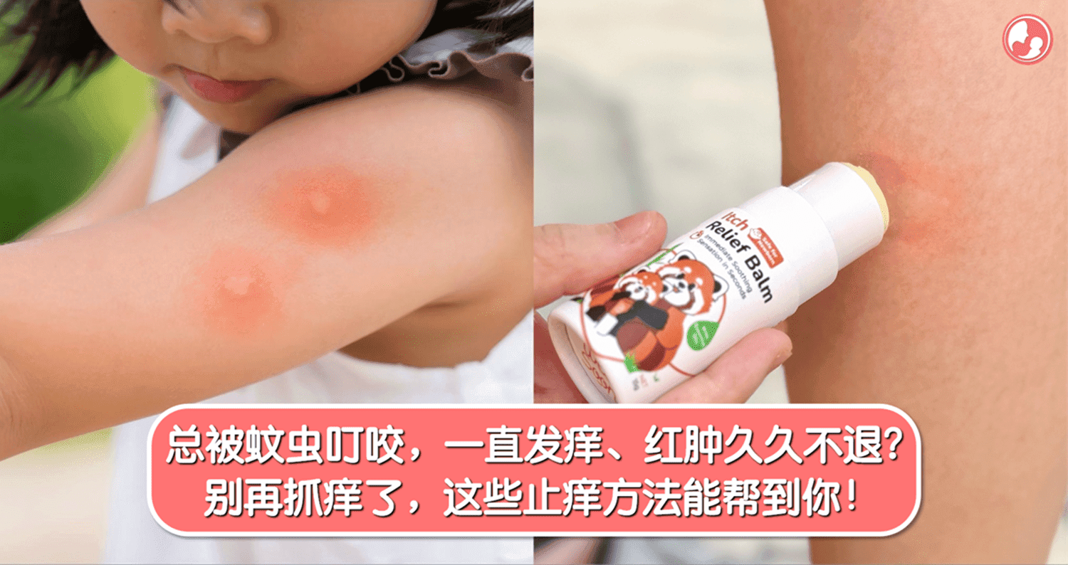 总被蚊虫叮咬,一直发痒、红肿久久不退?别再抓痒了,这些止痒方法能帮到你!