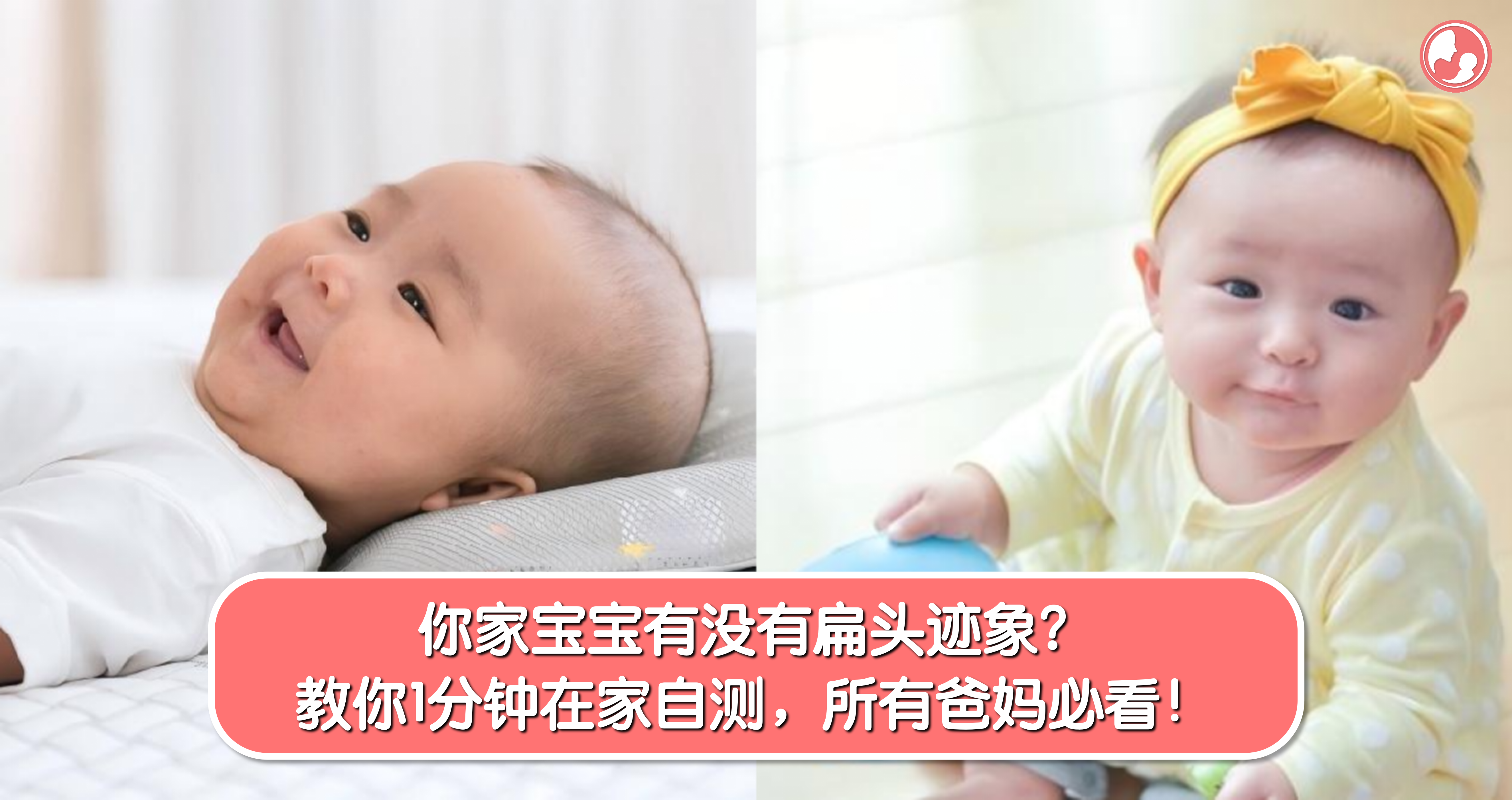 你家宝宝有没有扁头迹象?教你1分钟在家自测,所有爸妈必看!