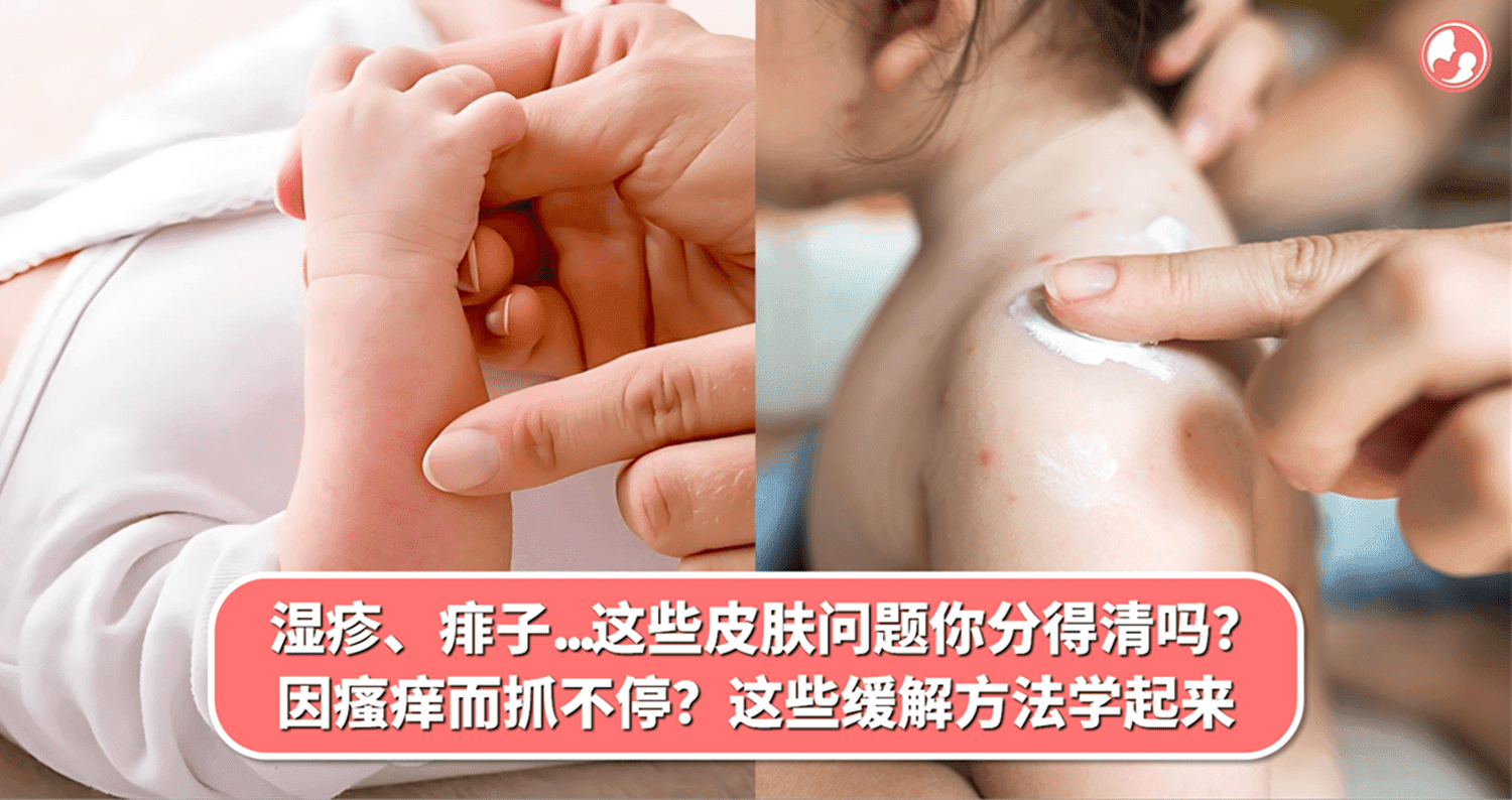 湿疹、痱子、荨麻疹…这些皮肤问题你分得清吗?孩子因瘙痒而抓不停?这些缓解方法先学起来