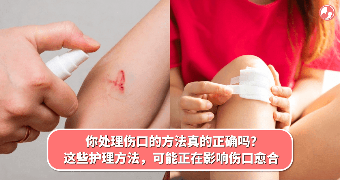 你处理伤口的方法真的正确吗?这些护理方法,可能正在影响伤口愈合