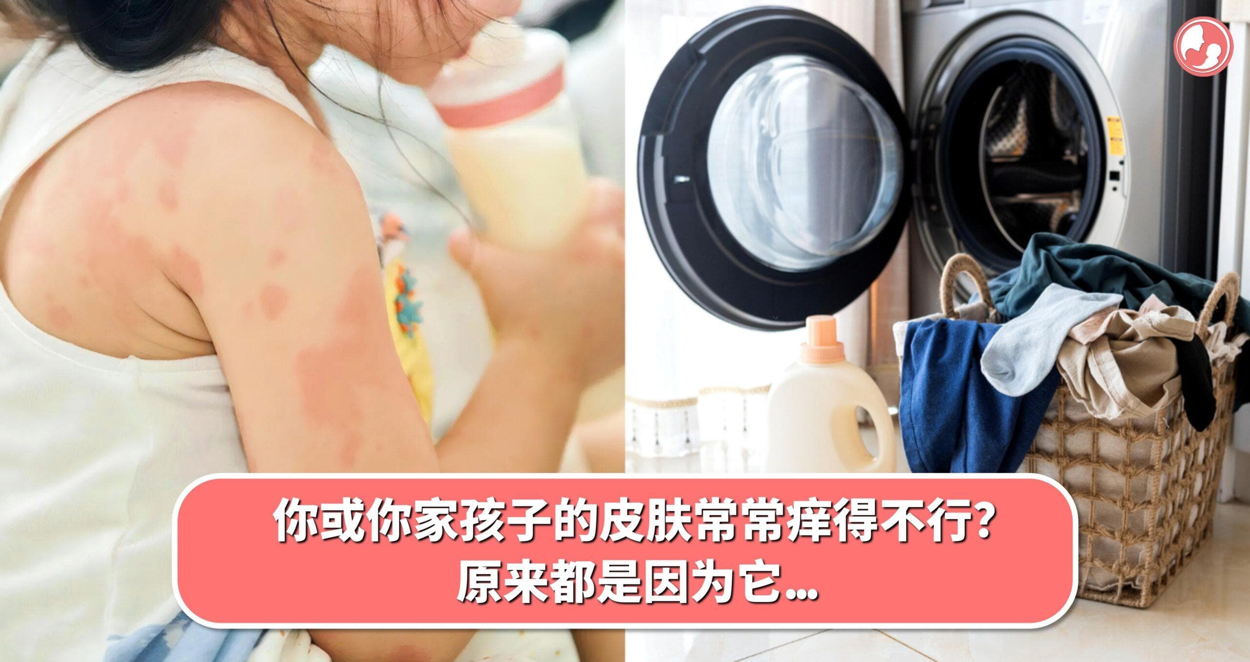 你或你家孩子的皮肤常常痒得不行?原来都是因为它…