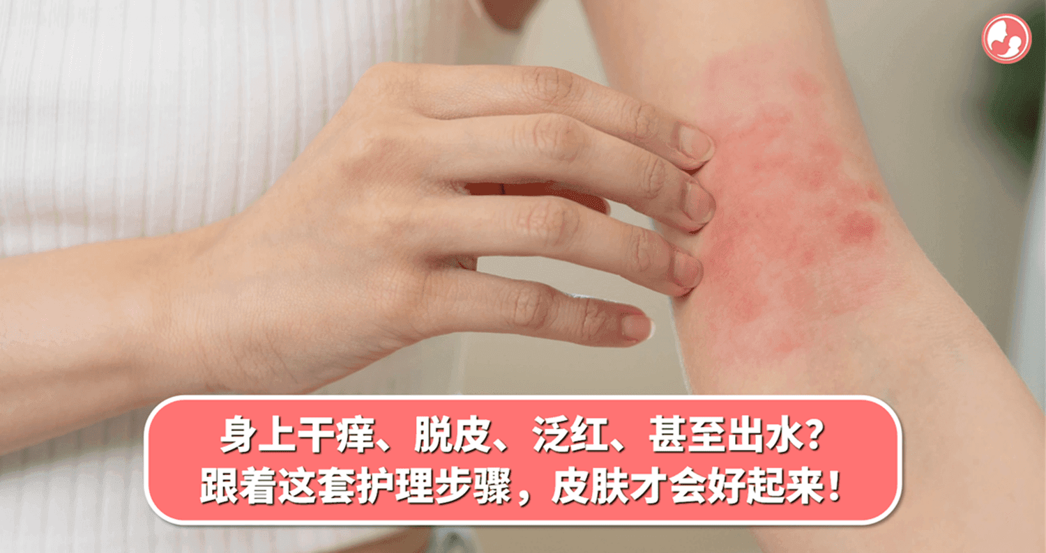 身上干痒、脱皮、泛红、甚至出水?跟着这套护理步骤,皮肤才会好起来!